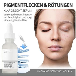 سرم ضدجوش و کنترل‌کننده چربی حاوی نیاسینامید 10% و زینک 1% اوردینری حجم 30 میل