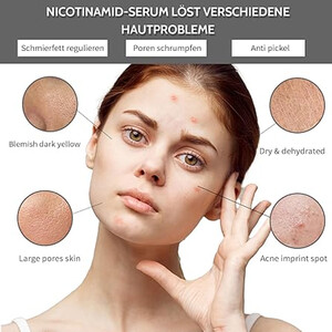 سرم ضدجوش و کنترل‌کننده چربی حاوی نیاسینامید 10% و زینک 1% اوردینری حجم 30 میل