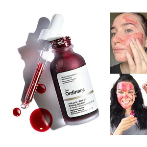 سرم پیلینگ و لایه‌بردار حاوی AHA 30% و BHA 2% اوردینری مدل Peeling Solution حجم 30 میل
