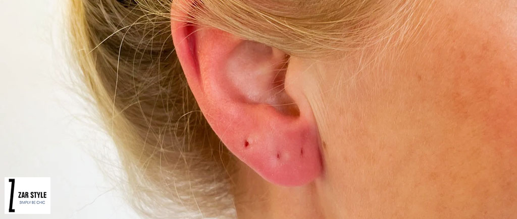 سوراخ گوش عفونت کرده