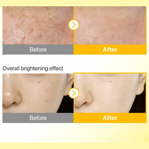 فروش سرم ضد آفتاب نامبوزین  تون آپ SPF50+