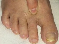 رفع درد و خستگی با فشار دادن انگشت پا+ عکس