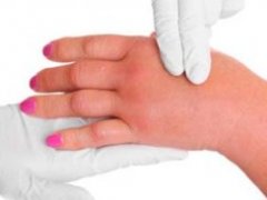 دلیل ورم کردن دست بعد از ورزش چیست؟