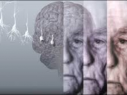 آلزایمر چگونه آغاز می شود؟