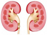۱۵ عادت آسیب ‌رسان به کلیه‌ ها