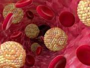 کلسترول‌خون بی‌صدا بالا می‌‌رود