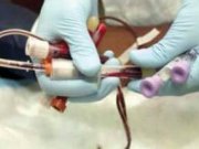 کشف دو گروه خونی جدید