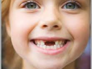 آيا دندان‌هاي شيري مهم‌اند؟