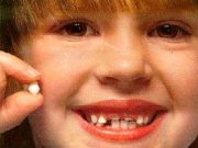 جلوگيری از زود افتادن دندانهای شيری