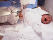 بهترین زمان ختنه !