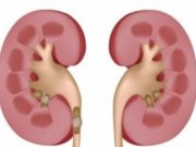 بهترين سنگ شکن کليه !؟