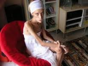 لاغری ناگهانی را جدی بگیرید