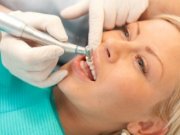 همه چيز درباره يک باور غلط دندانی