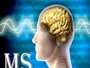 11 نکته برای دوری از ms