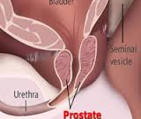 درمان گياهي بيماري پروستات !!!