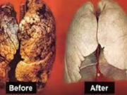 روزهای آلودگی هوا در 72 ساعت شش هایتان را برق بیاندازید!