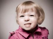 علت و درمان دندان قروچه کودکان