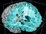 ارايه دقيق ترين تصوير سه بعدی از مغز انسان‎