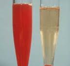 وجود خون در ادرار (هماچوری)