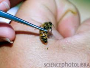 زنبور درمانی