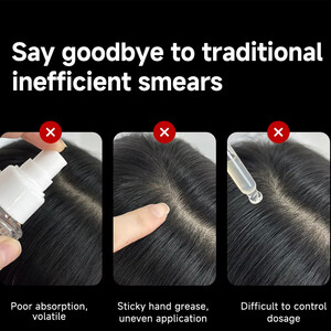 شانه ارتعاشی نور درمانی قرمز شیائومی برای تحریک رشد مو