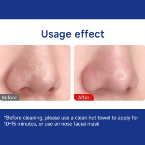 فروش دستگاه پاک‌کننده جوش سرسیاه صورت چندکاره دوکو شیائومی