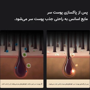 شانه ارتعاشی نور درمانی قرمز دوکو شیائومی برای مراقبت و  تحریک رشد مو