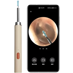 خرید گوش پاک‌کن اسمارت دوربین‌دار قابل شارژ شیائومی دیدن مجرای داخلی گوش