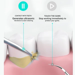 کیفیت جرم‌گیر دندان خانگی هوشمند قابل شارژ شیائومی