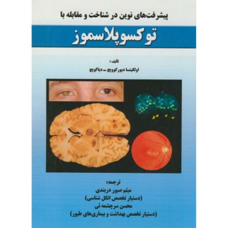 کتاب پیشرفت های نوین در شناخت و مقابله با توکسوپلاسموز