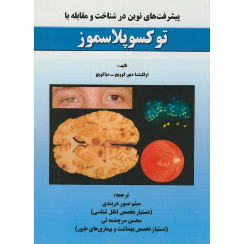 پیشرفت های نوین در شناخت و مقابله با توکسوپلاسموز