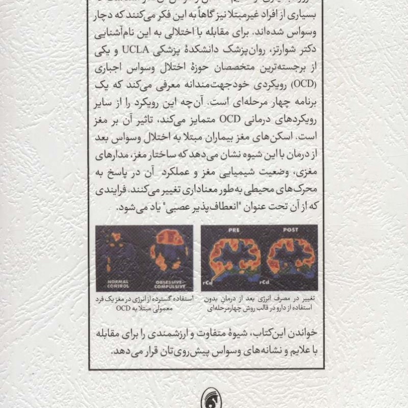 قفل گشایی از مغز وسواسی
