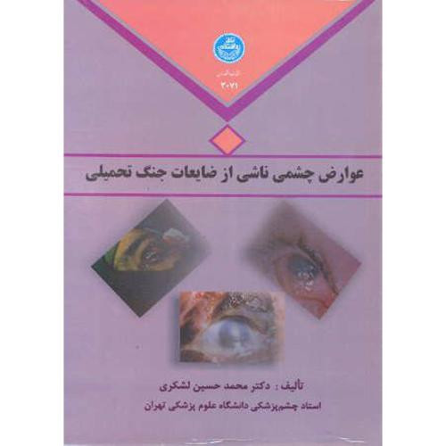 عوارض چشمی ناشی از ضایعات جنگ تحمیلی