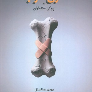 ژن خوب و پوکی استخوان