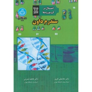 سندرم داون
