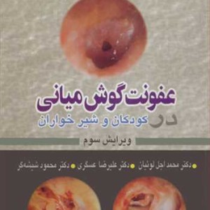 عفونت گوش میانی کودکان و شیرخواران