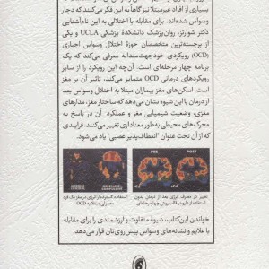 قفل گشایی از مغز وسواسی