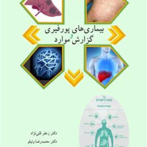 بیماری های پورفیری و گزارش موارد