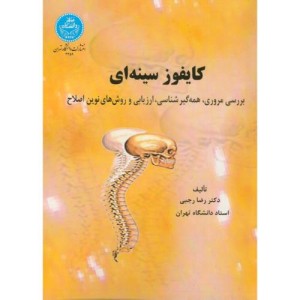 کتاب کایفوز سینه ای