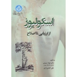 اسکولیوز