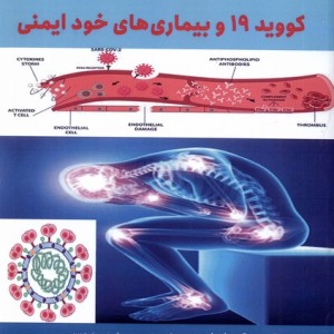 کتاب کووید 19 و بیماری های خود ایمنی مرسل
