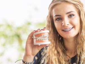 نقش اصطکاک در ارتودنسی