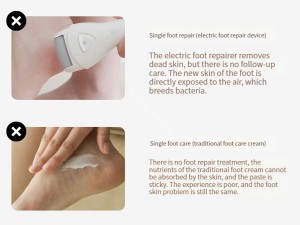 دستگاه پدیکور برقی پا شیائومی Xiaoshi Callus Remover B1-W