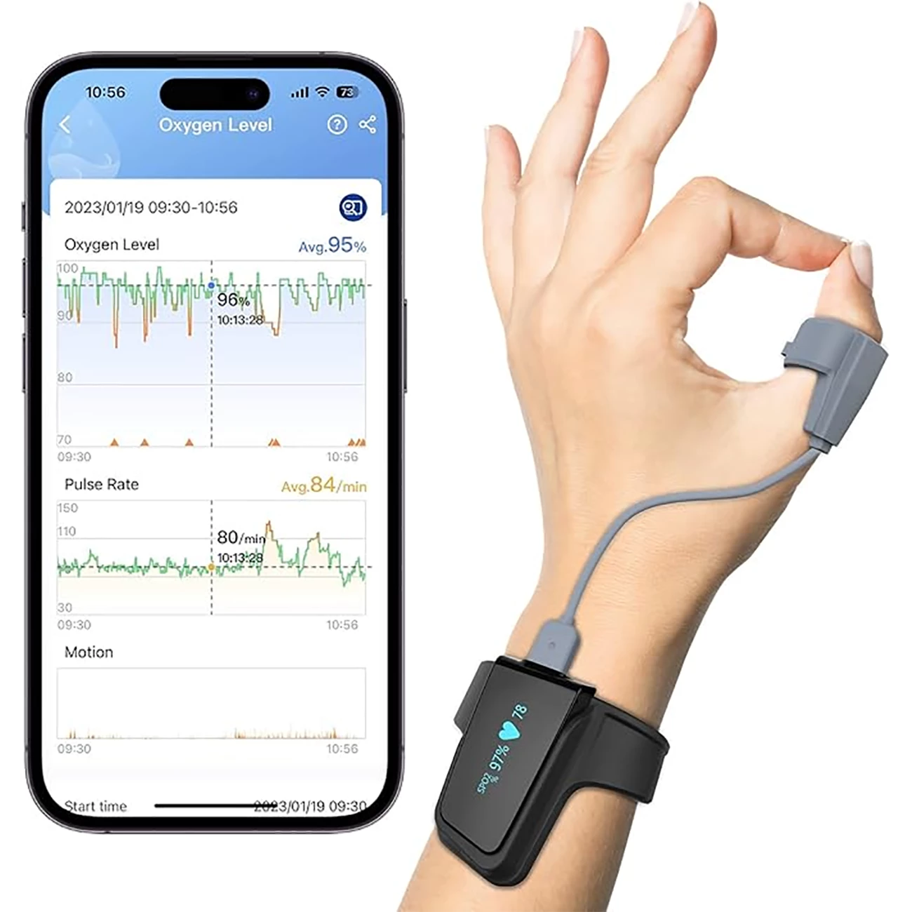 پالس اکسیمتر مچی هوشمند ویاتوم Checkme O2 Max