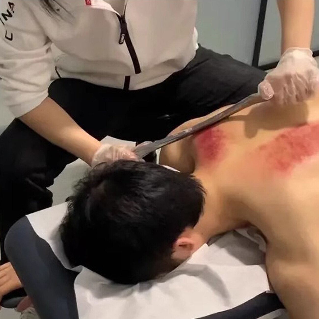 قیمت ست حرفه‌ای ماساژ و درمان عضلات فاشیا