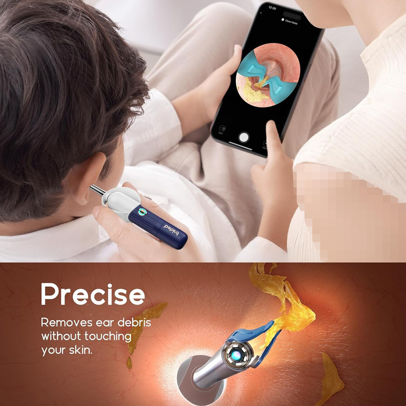 فروش دستگاه تمیز کننده گوش شیائومی