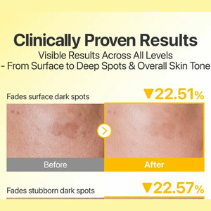 خرید سرم ضد آفتاب نامبوزین  تون آپ SPF50+