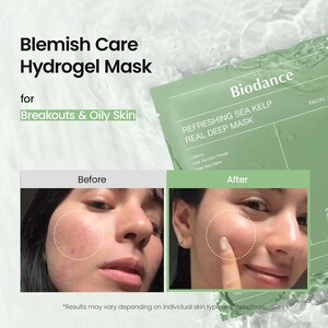 خرید ماسک هیدروژلی بایودنس