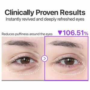 نتیجه استفاده پچ زیر چشم