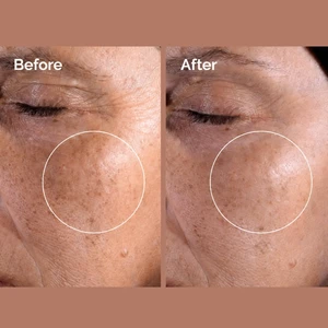تونر اوردینری لایه بردار و شفاف کننده پوست
